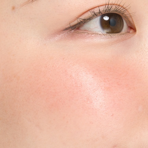 CC16image