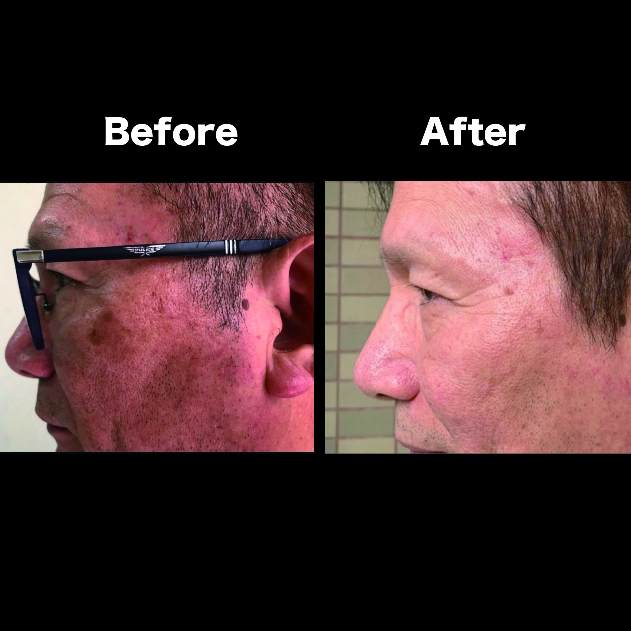 PA對比_工作區域 1