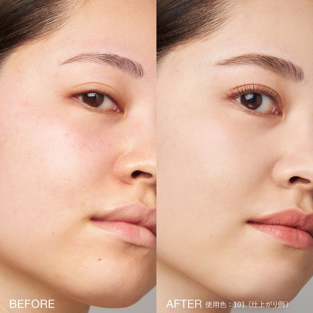 before-after-LGCFD