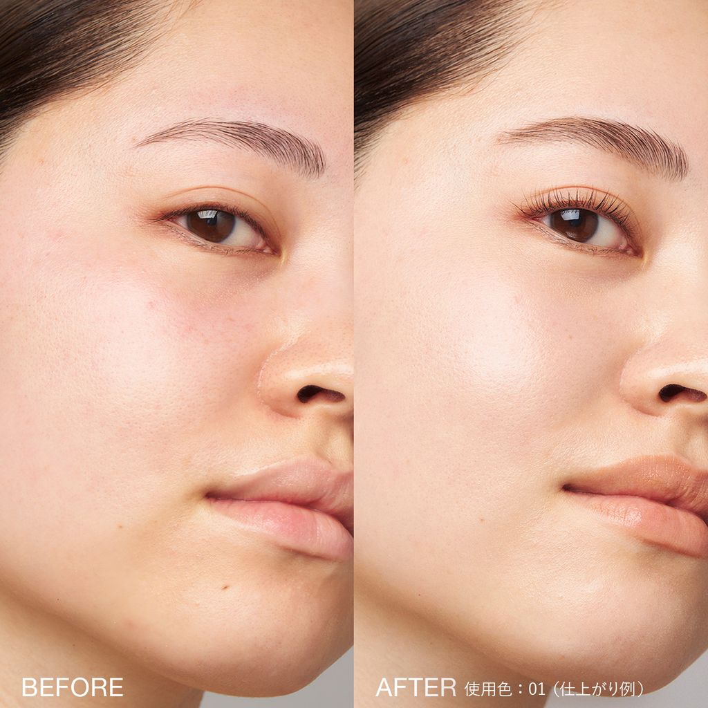 before-after-ST