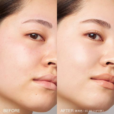 before-after-ST