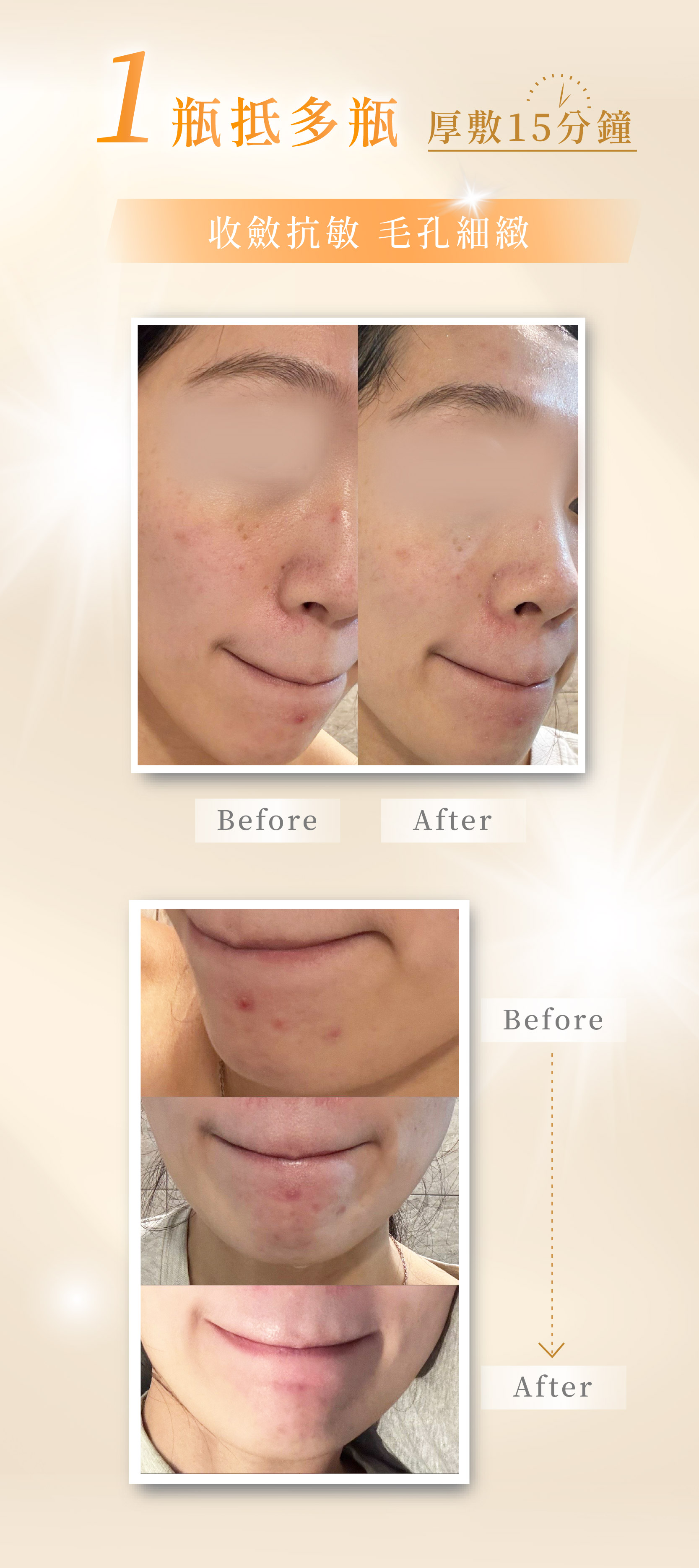 金盞花凍膜_二修_3