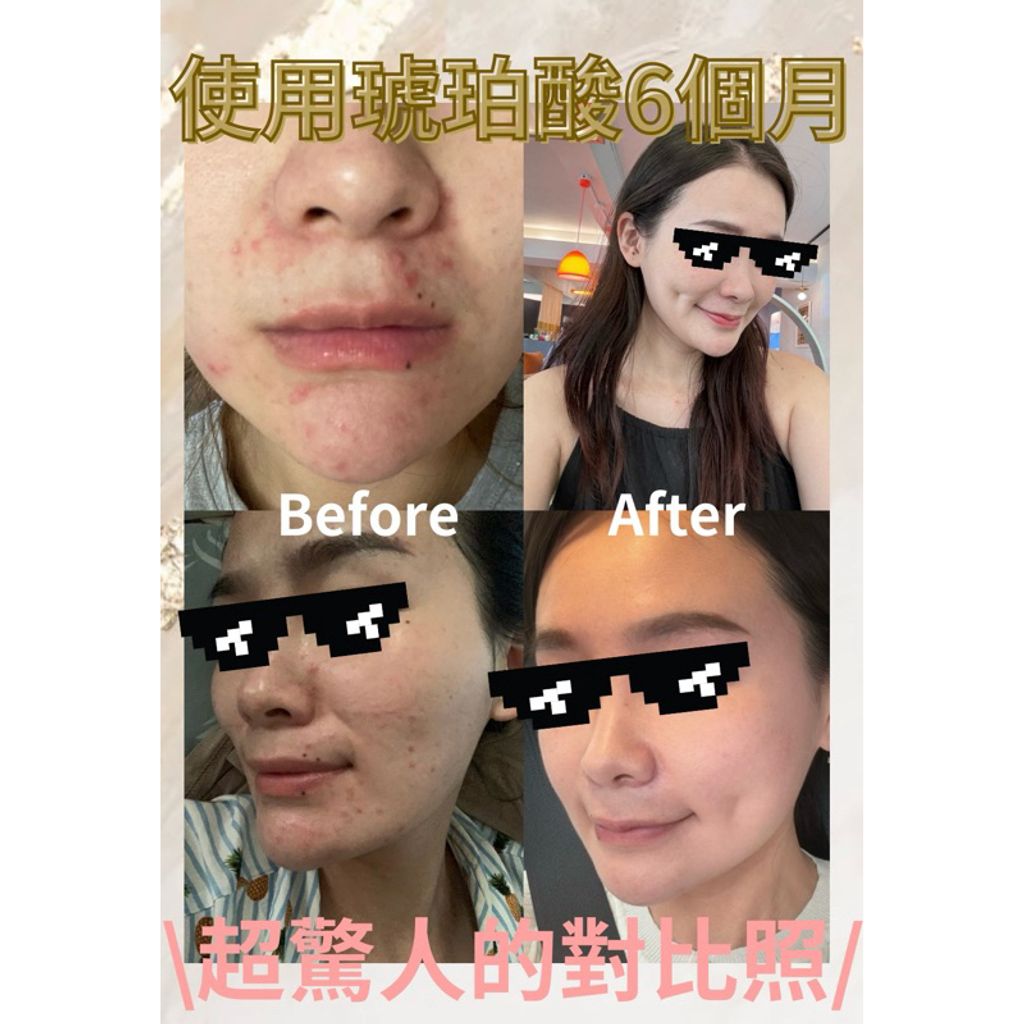 tw-11134207-7rasa-m0vioa7kehuv7e