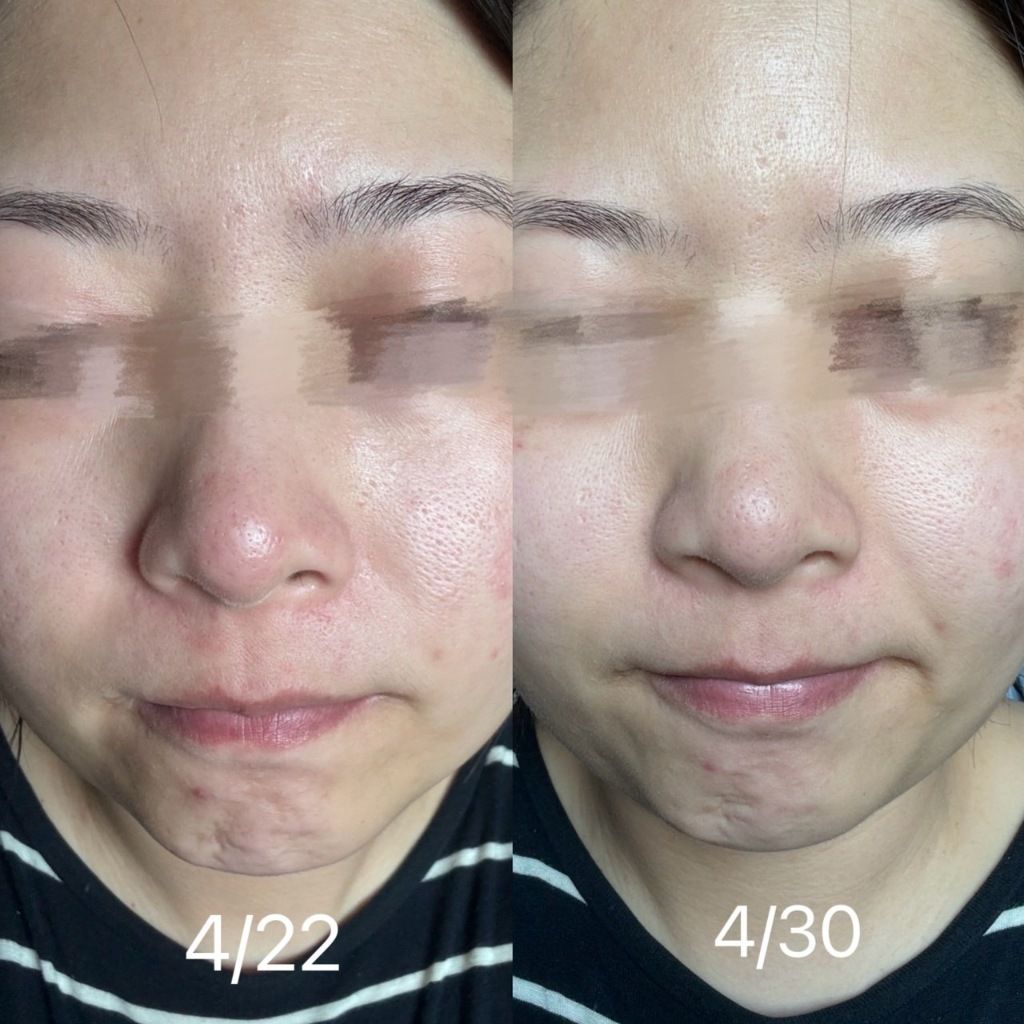 tw-11134207-7r98w-lutb8xn5e56z15