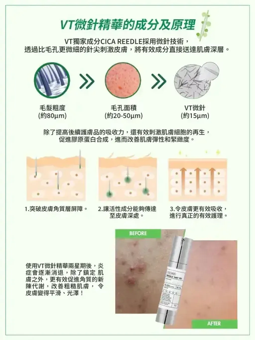 VT微针精华3