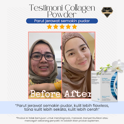 Testimoni Collagen Plus Powder 02