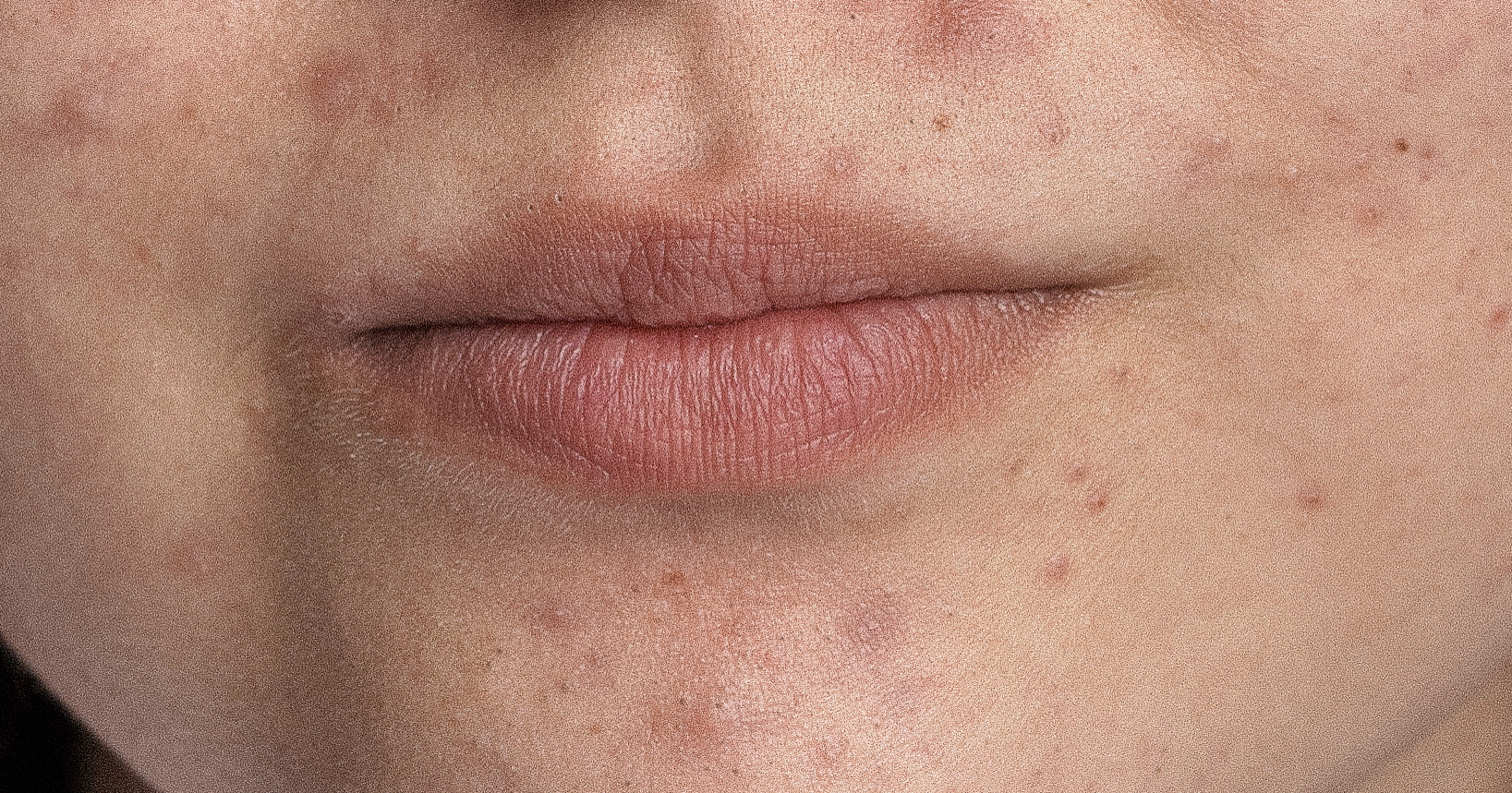close-up-skin-pores-face-care-routine