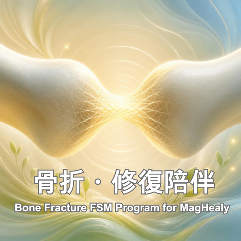Fr 骨折 Bone Fracture