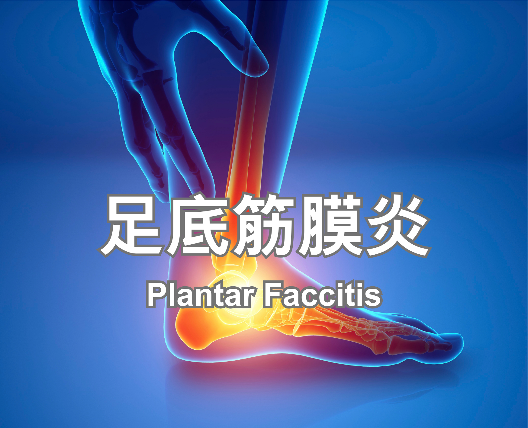 Plantar Faccitis
