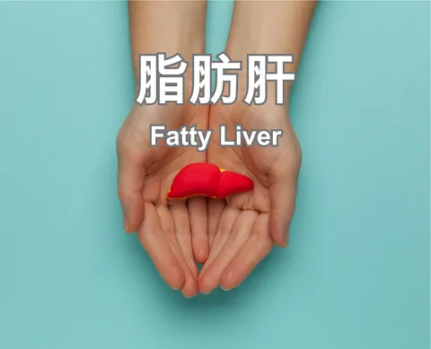 Fatty Liver