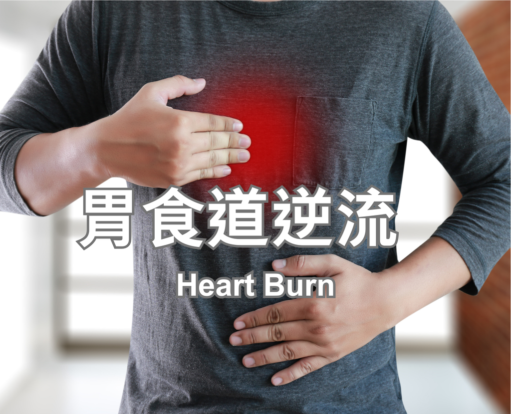 Heart Burn