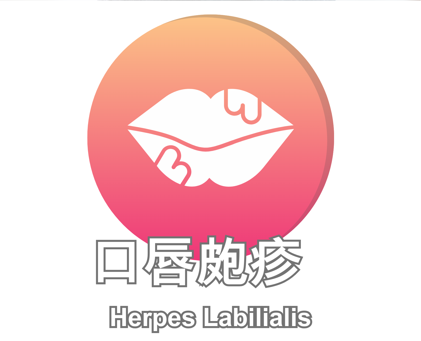 Herpes Labilialis