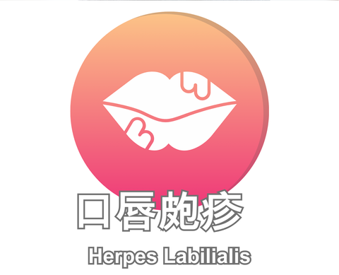 Herpes Labilialis