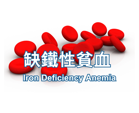 Iron Deficiency Anemia