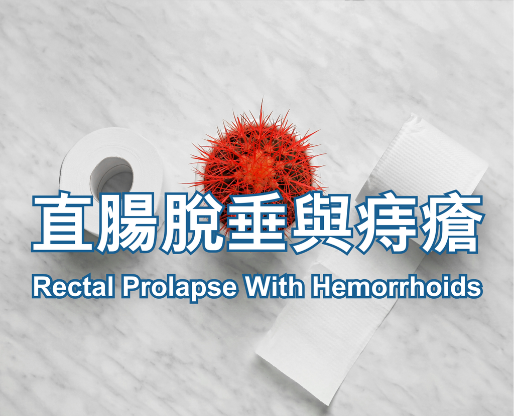 Rectal Prolapse With Hemorrhoids