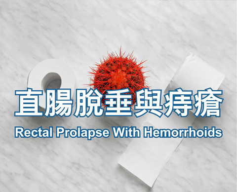Rectal Prolapse With Hemorrhoids