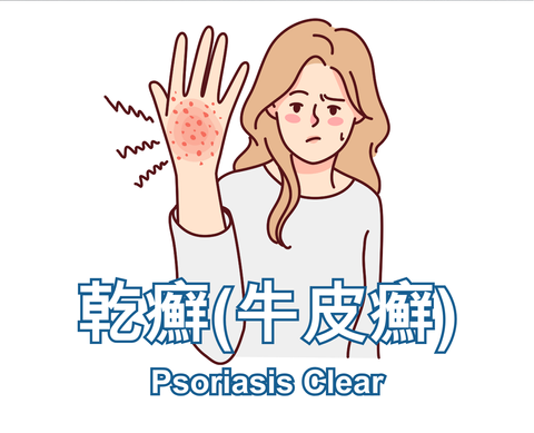 Psoriasis Clear 乾癬牛皮癬
