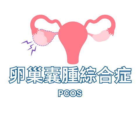 PCOS