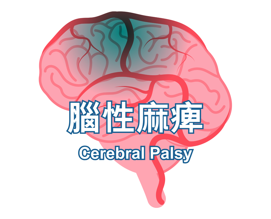 Cerebral Palsy