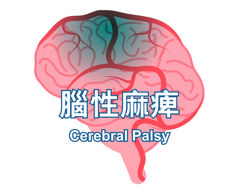 Cerebral Palsy