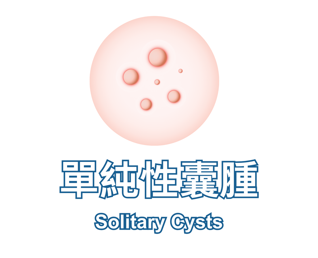 Solitary Cysts