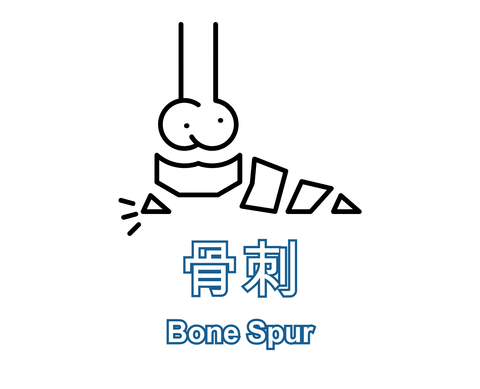 Bone Spur 骨刺