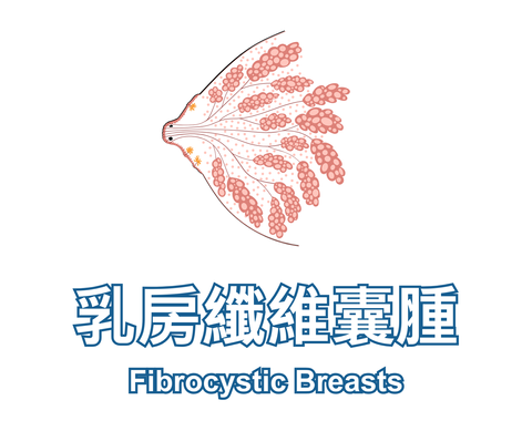 Fibrocystic Breasts 乳房纖維囊腫