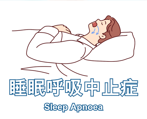 Sleep Apnoea