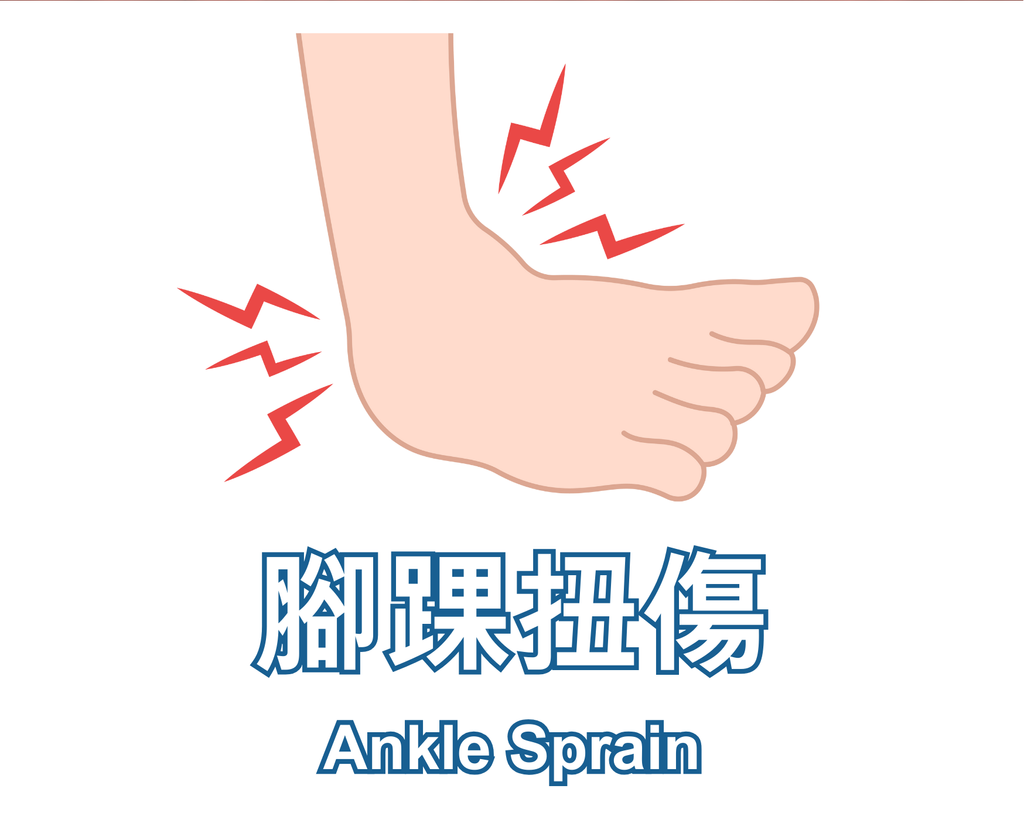 Ankle Sprain 腳踝扭傷