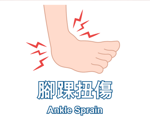 Ankle Sprain 腳踝扭傷