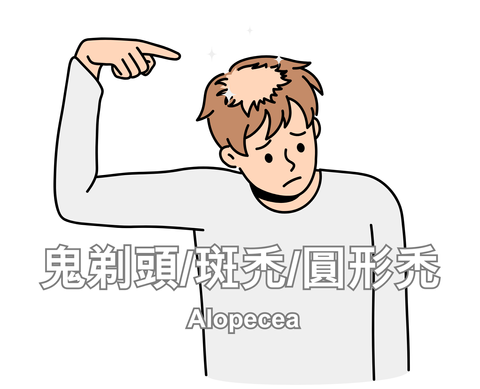 Alopecea