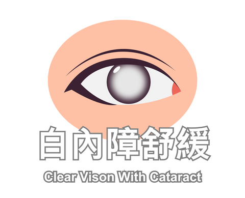 Clear Vison With Cataract