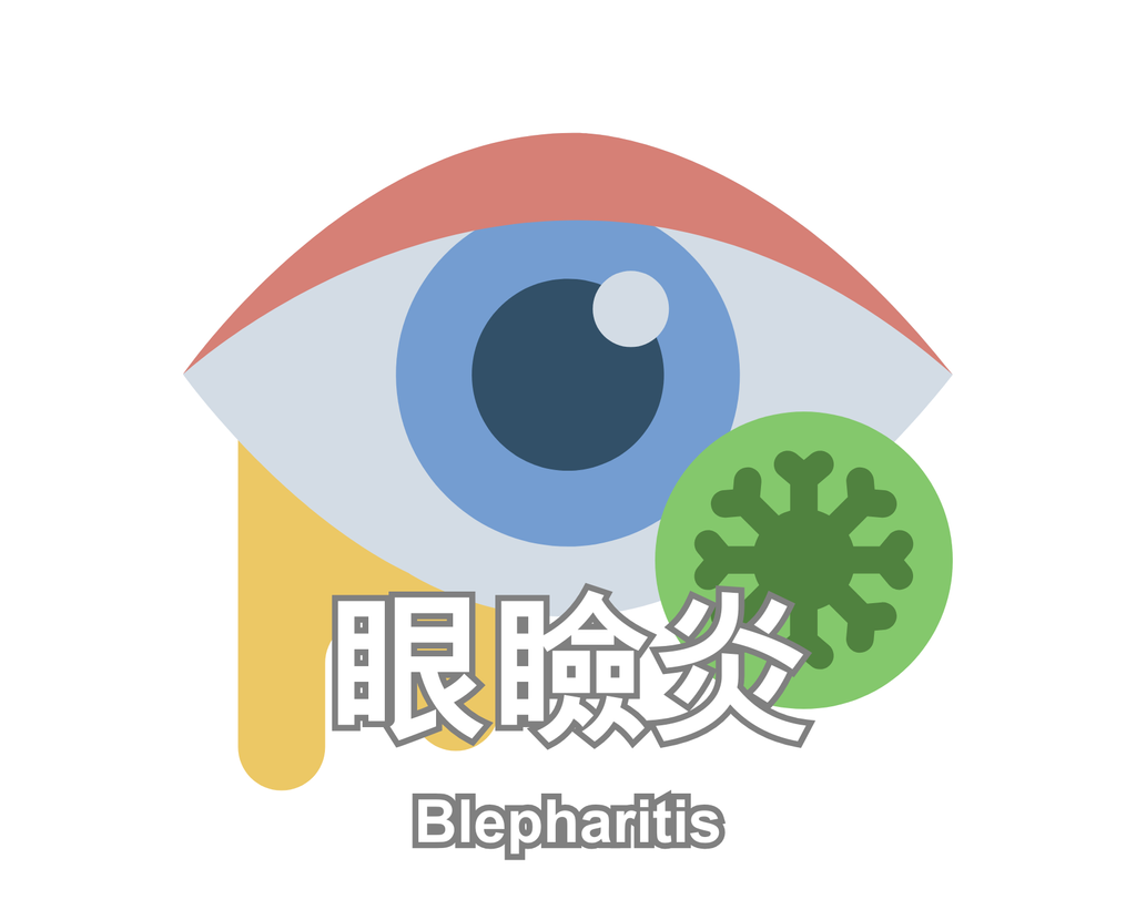 Blepharitis