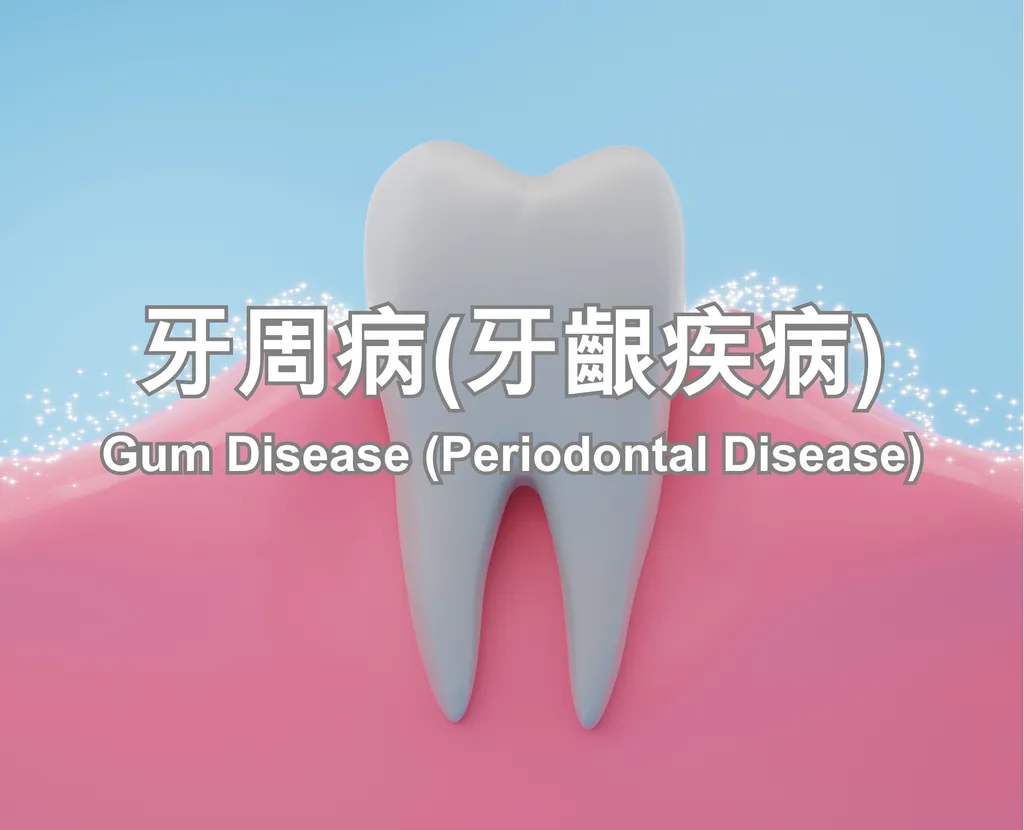 Gum Disease (Periodontal Disease)