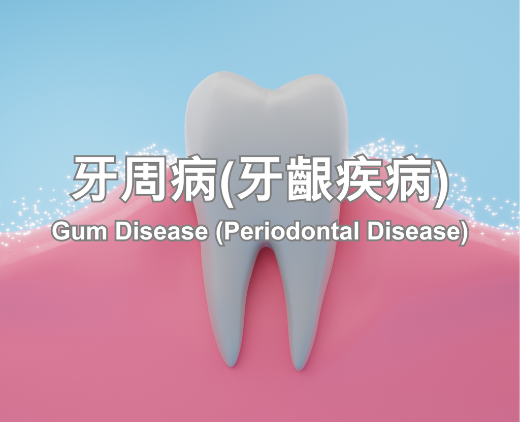 Gum Disease (Periodontal Disease)