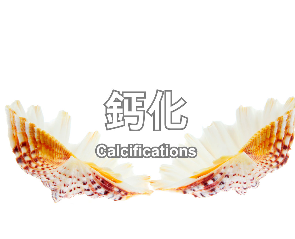 Calcifications