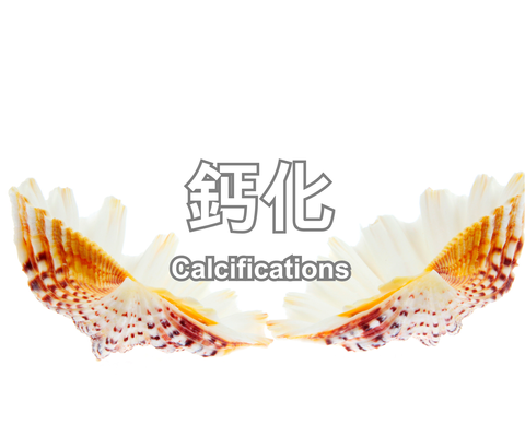 Calcifications