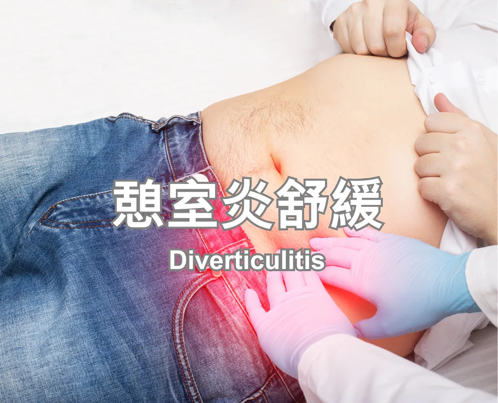 Diverticulitis