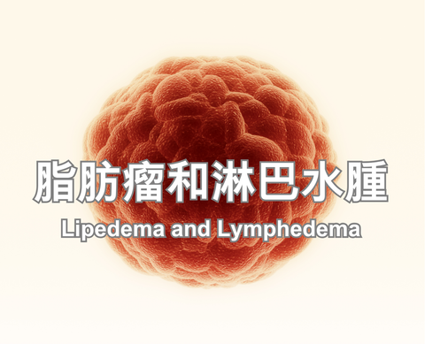 Lipedema and Lymphedema