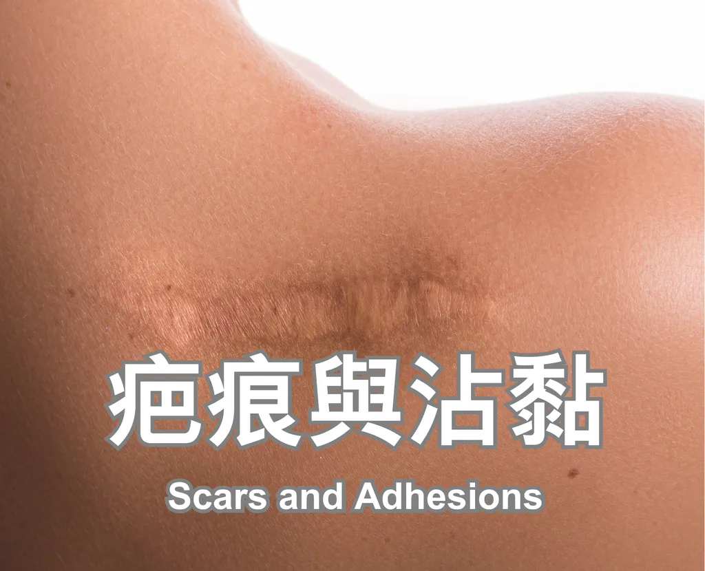 Scars and Adhesions