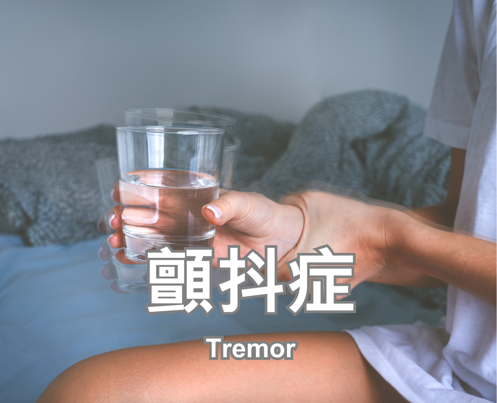 Tremor