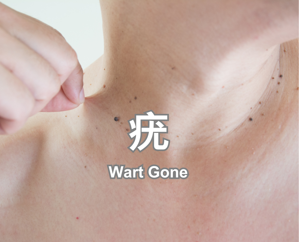 Wart Gone