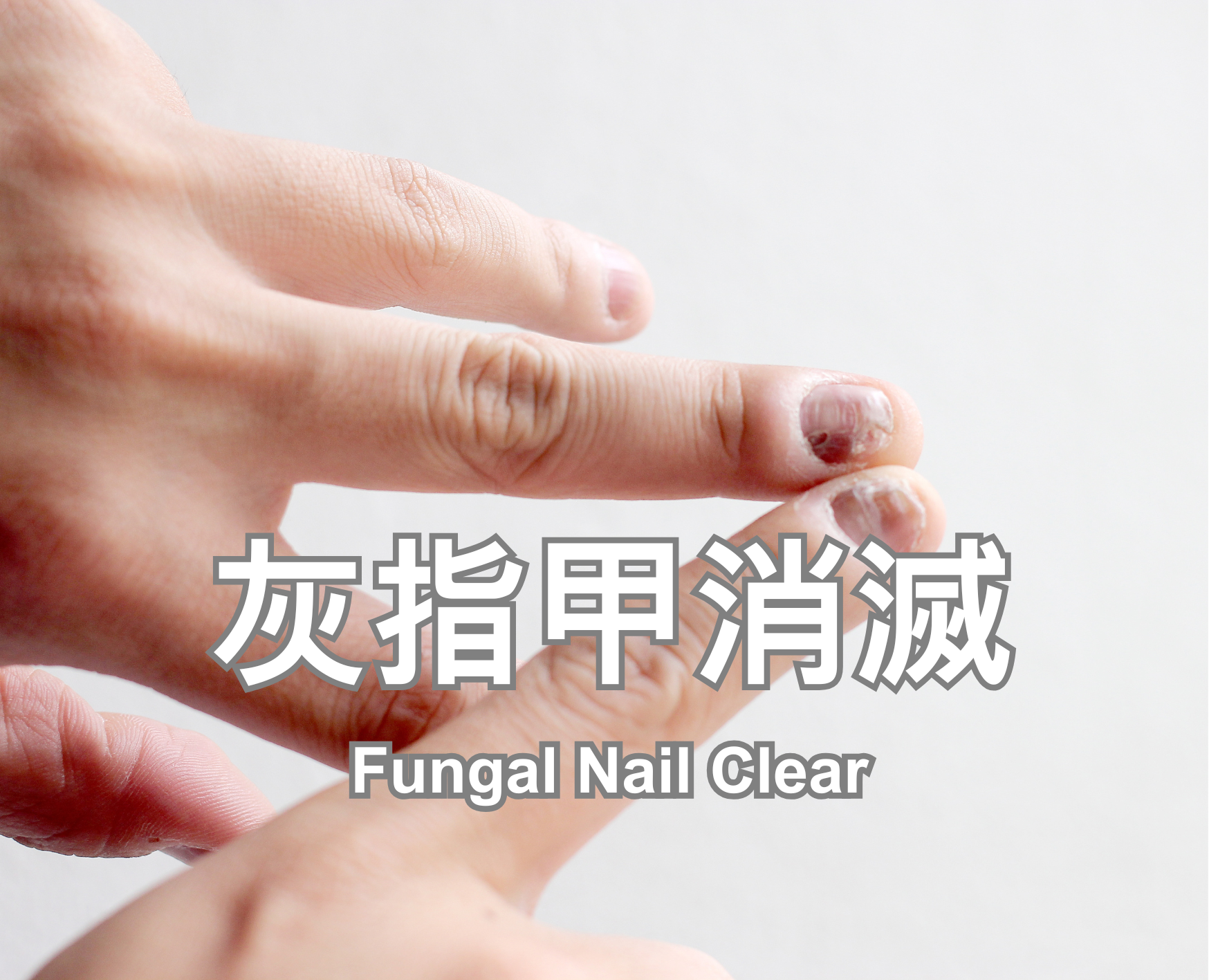 Fungal Nail Clear
