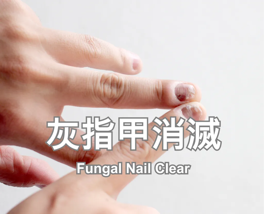 Fungal Nail Clear
