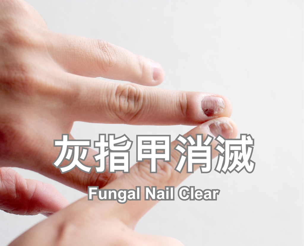 Fungal Nail Clear