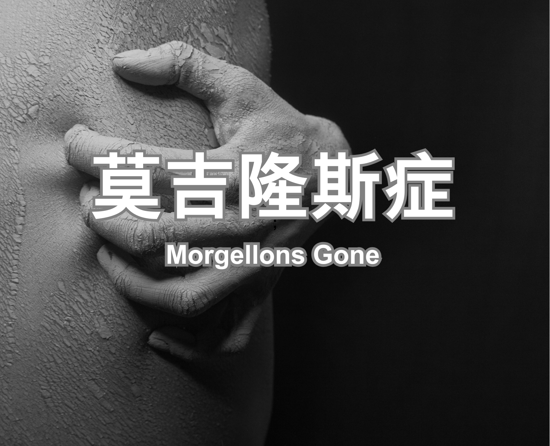莫吉隆斯症