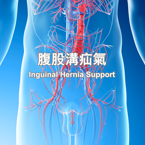 腹股溝疝氣-480x480