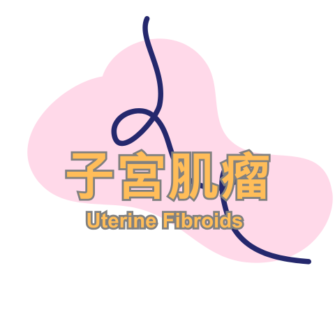 子宮肌瘤