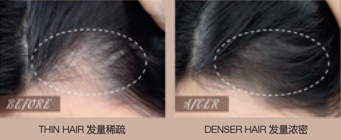 Thin Hair Before