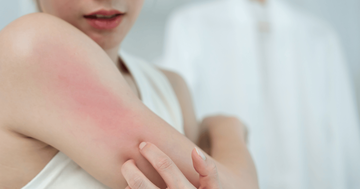 洗完澡皮膚癢怎麼辦？揭開 7 大隱藏原因與舒緩對策